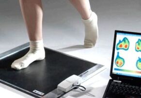 Diagnóza hallux valgus