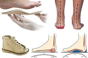 ortopedická obuv pre hallux valgus u dieťaťa