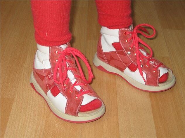 topánky pre deti s hallux valgus