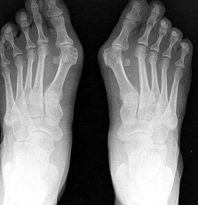 X -RAY NEPOSKYTU